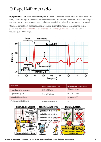 ECG explicado do zero