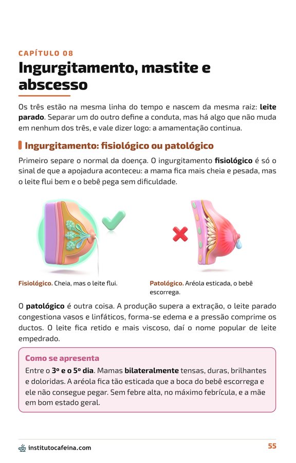 Página do ingurgitamento, mastite e abscesso