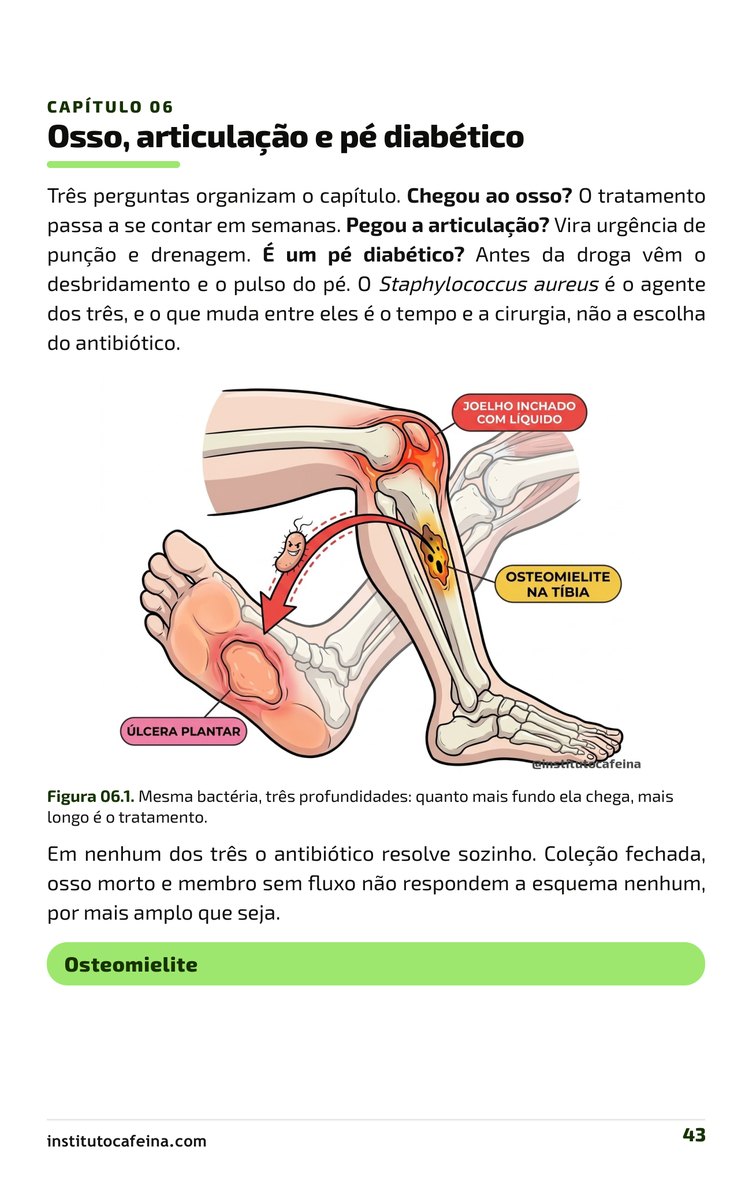 Página da osteomielite e do pé diabético